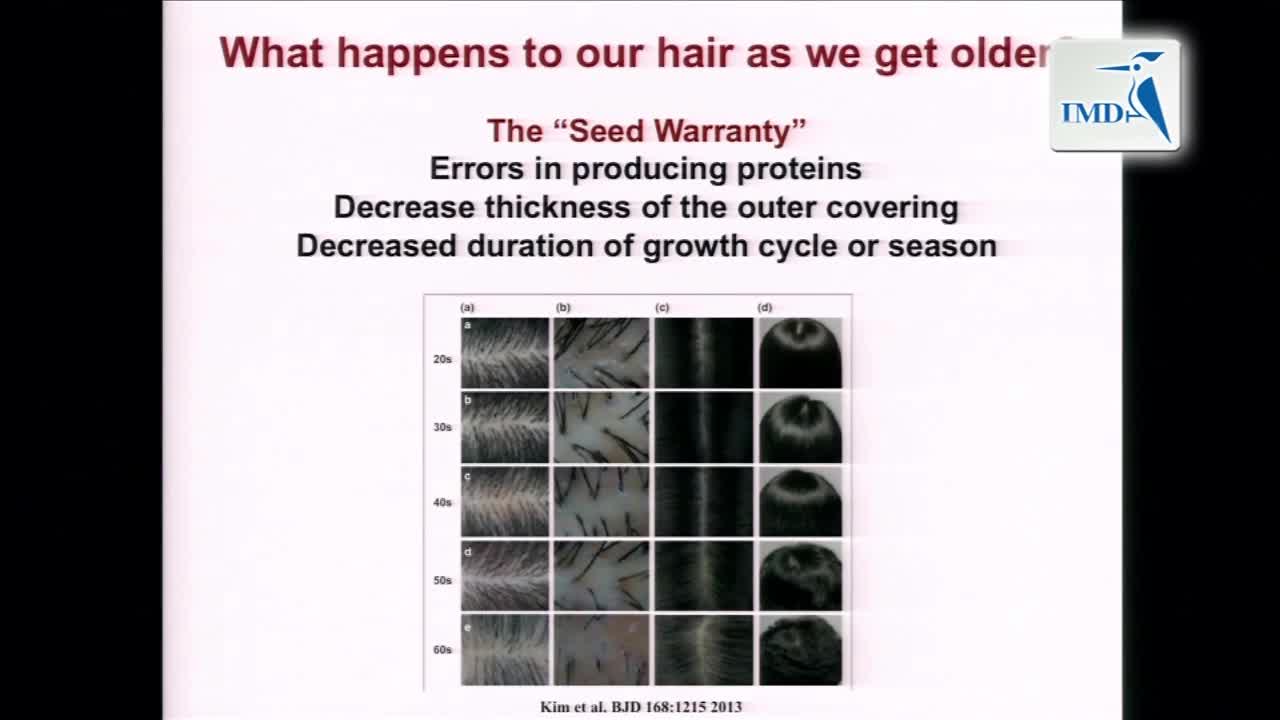 脱发的新兴治疗方法（4）