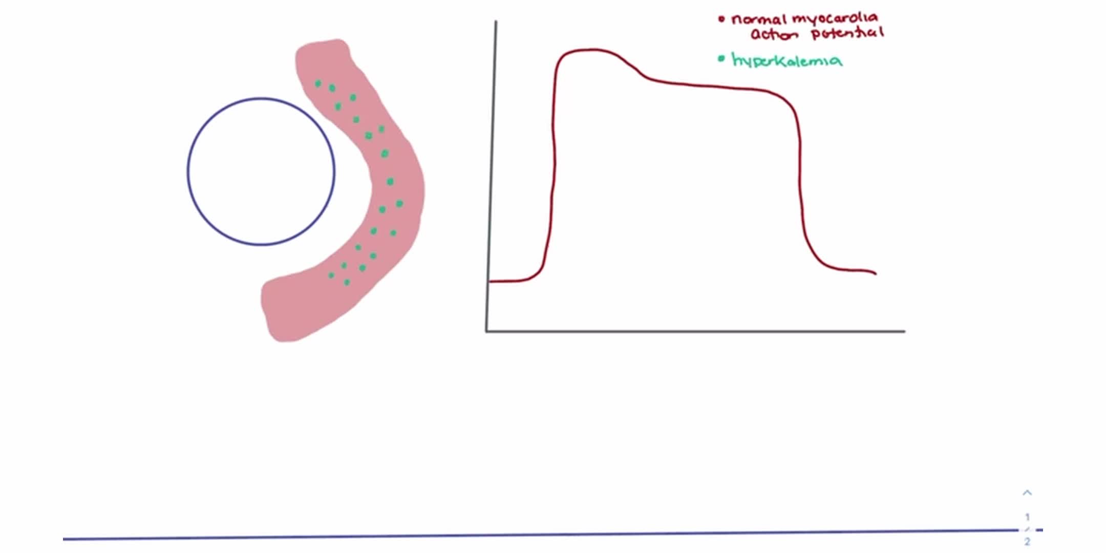 揭秘高钾血症：心肌细胞的危机