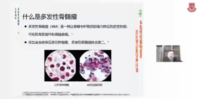 杨文忠-多发性骨髓瘤患者讲堂