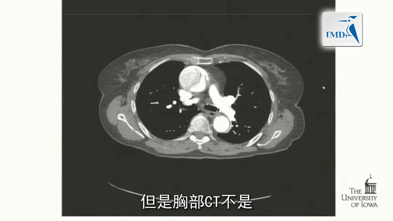急性卒中治疗流程：人为因素与常见错误（3）