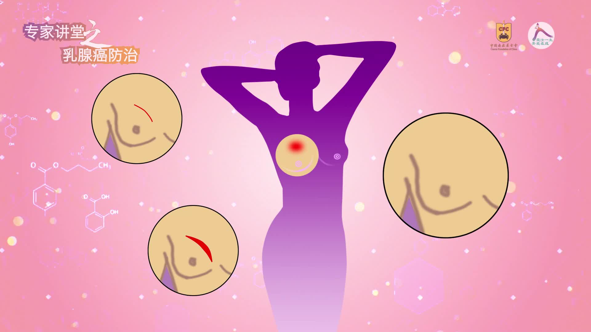 27 陈文林-乳腺癌术后应注意哪些问题