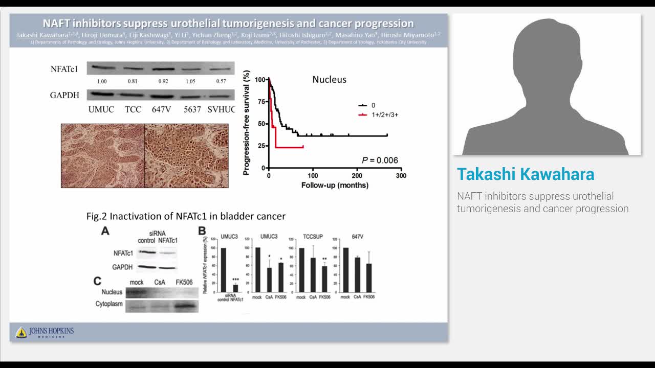 NAFT inhibitors suppress urothelial tumorigenesis and can..-