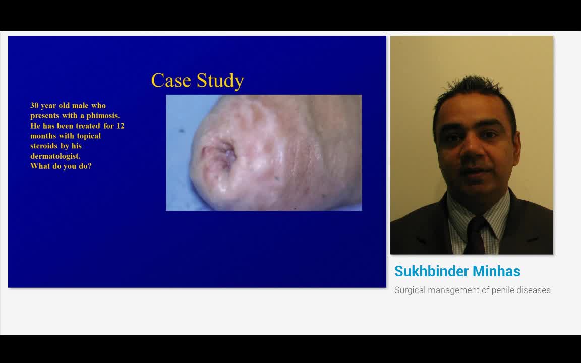 Surgical management of penile diseases