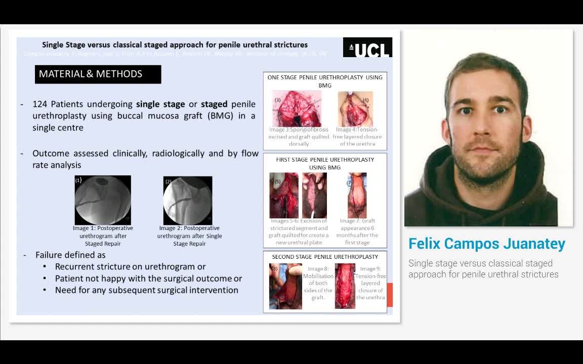 Single stage versus classical staged approach for penile ..-