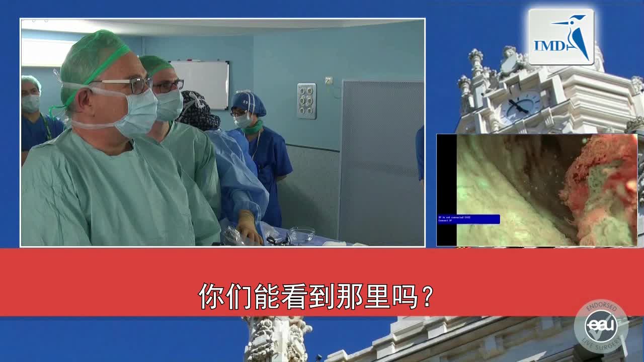 NBI和OCT影像辅助技术（预告）