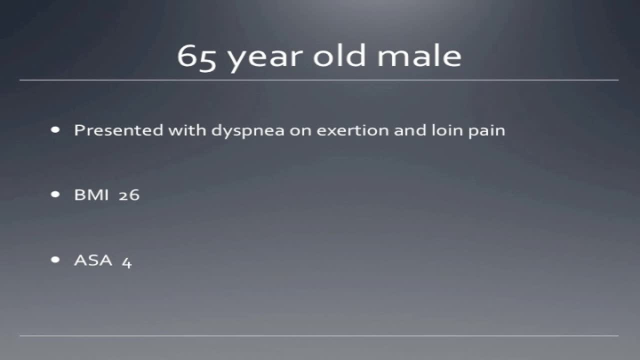 Two stage management of renal tumours with atrial thrombu..-