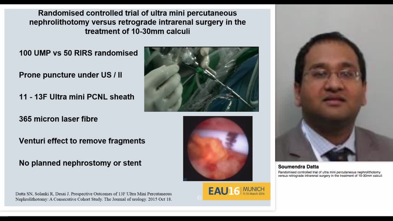 Randomised controlled trial of ultra mini percutaneous ne-