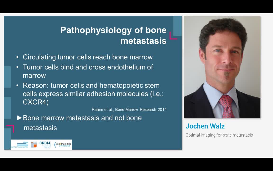 Optimal imaging for bone metastasis