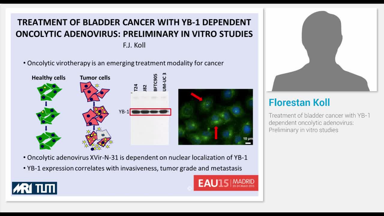 Treatment of bladder cancer with YB-1 dependent oncolytic..-