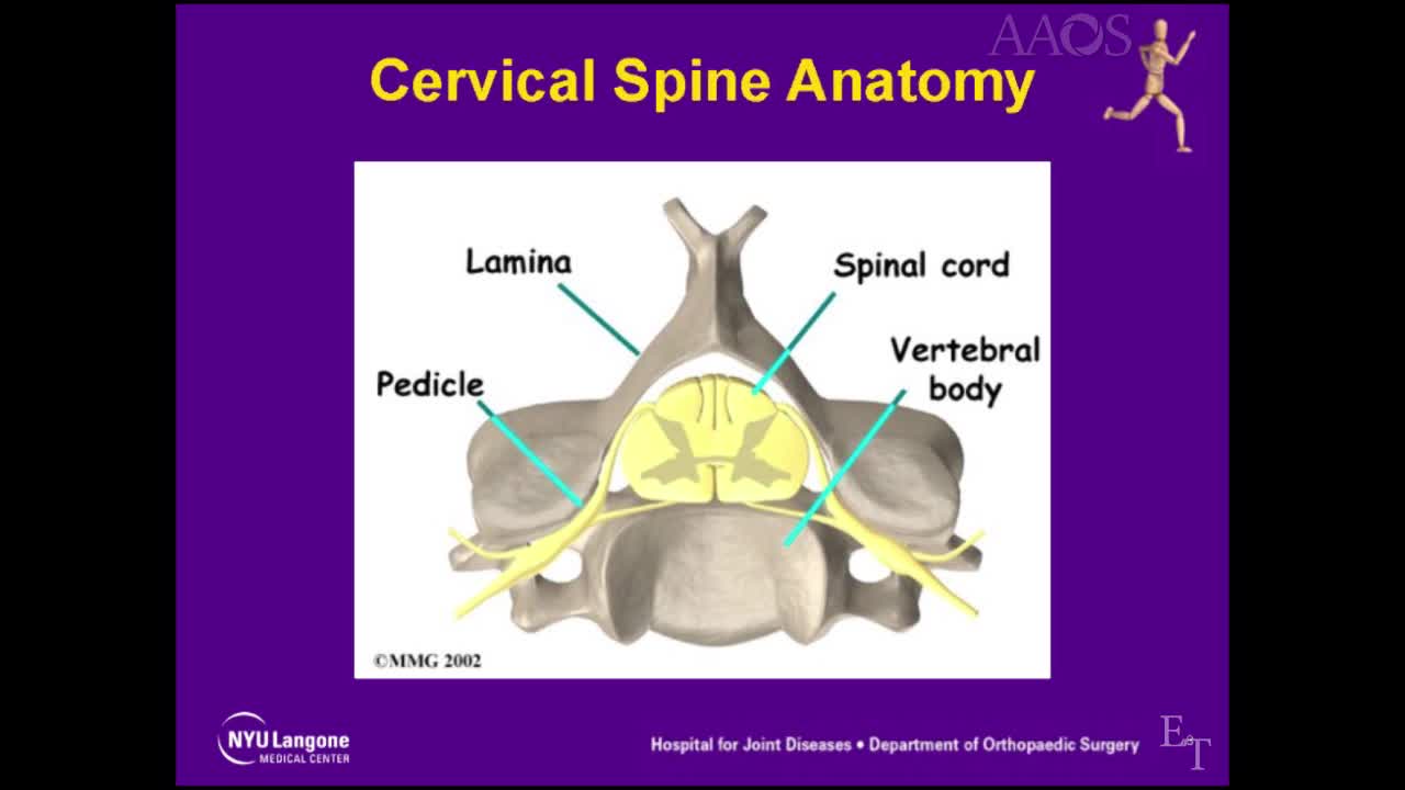 French-Door Laminoplastyaka Double-Door Laminoplasty