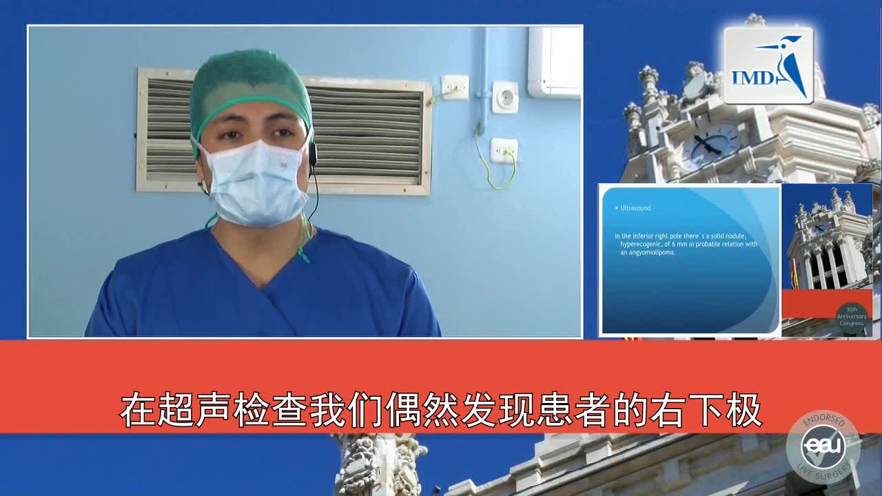 3D-HD腹腔镜肾部分切除术（1）