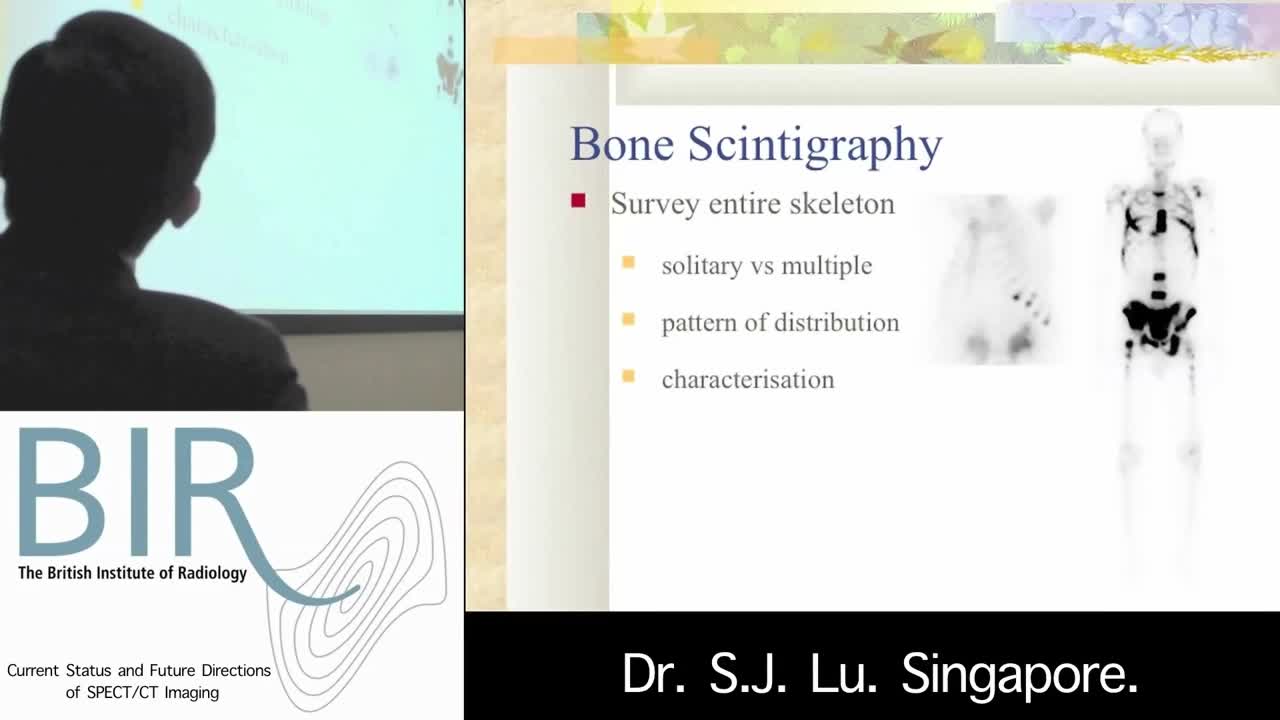 SPECT和CT侦测膝盖疼痛（1）