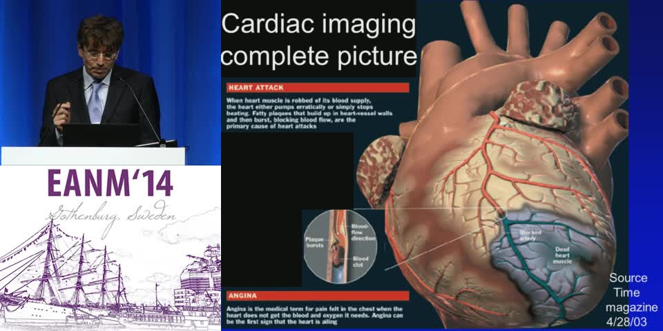 多模态成像在心脏病学中的应用