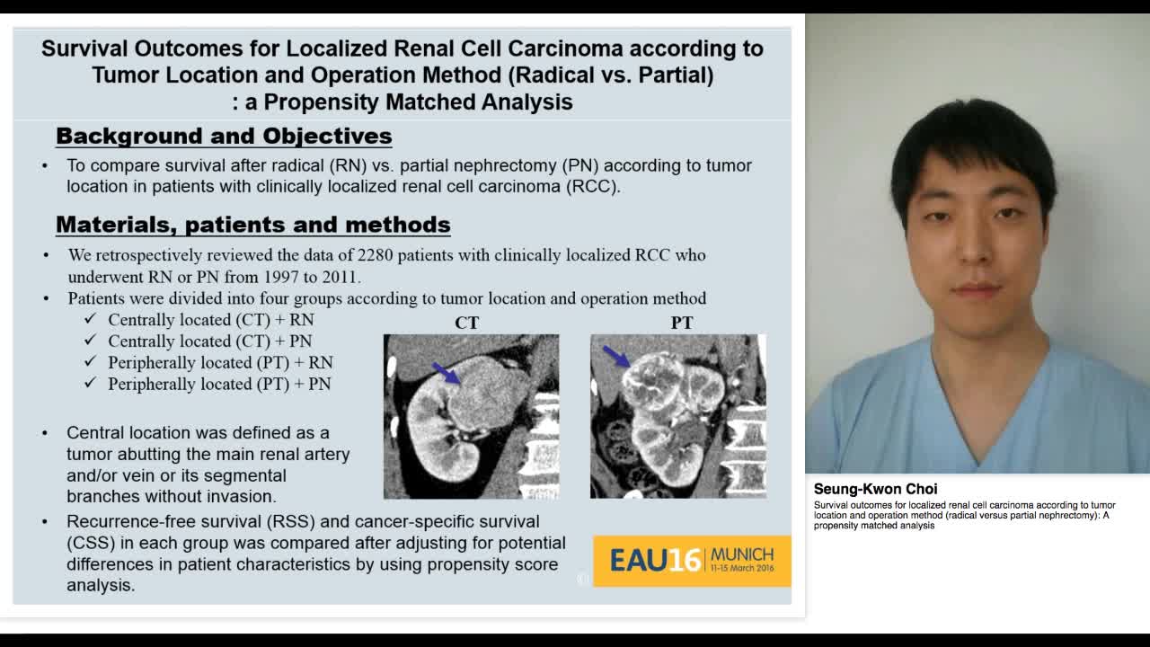 Survival outcomes for localized renal cell carcinoma acco-