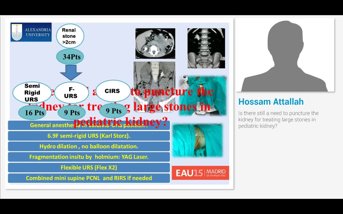 Is there still a need to puncture the kidney for treating..-