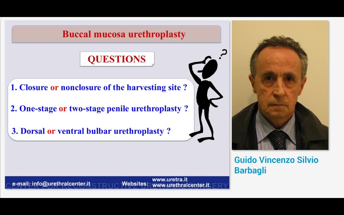 Buccal mucosa urethroplasty