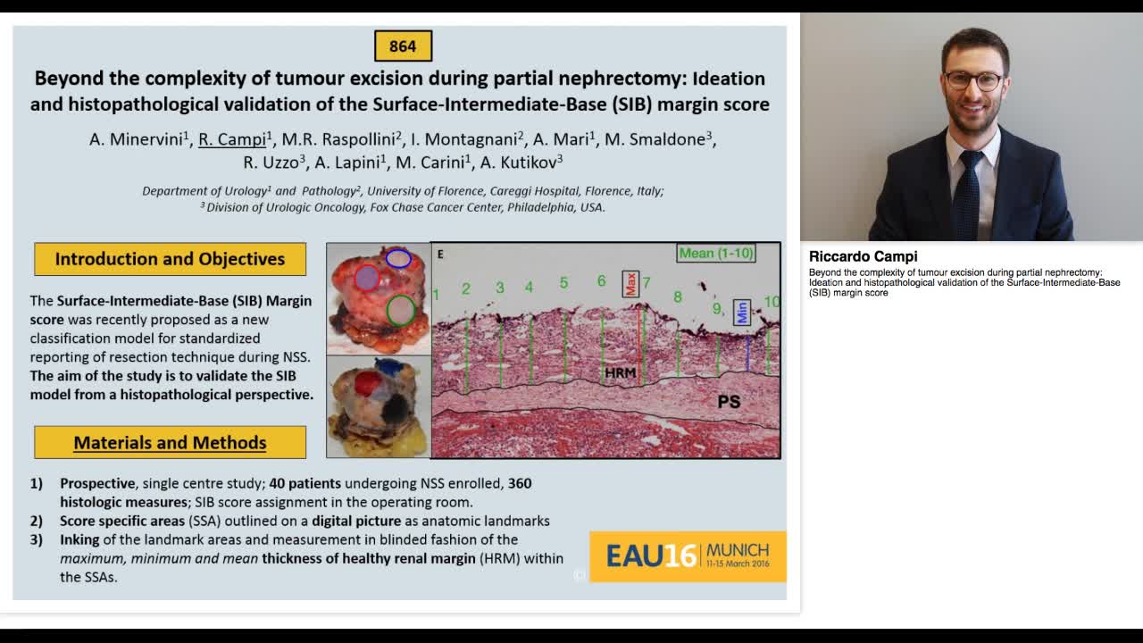 Beyond the complexity of tumour excision during partial n-