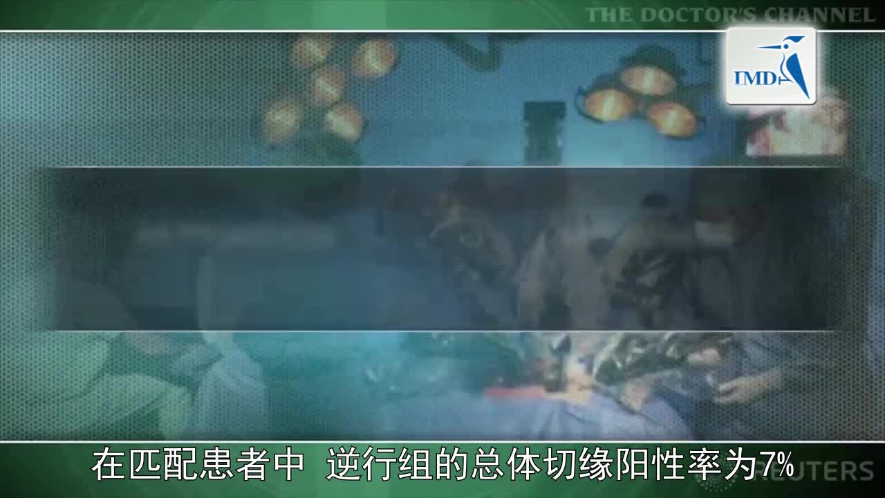 前列腺切除术中逆行神经保留方式可提高性功能恢复