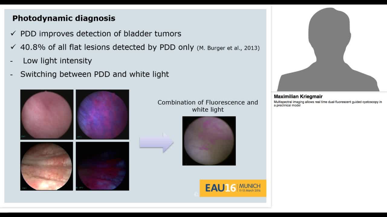 Multispectral imaging allows real time dual-fluorescent g-