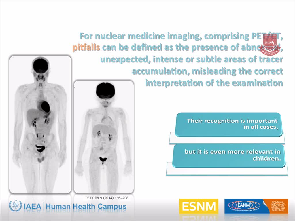 儿科：PET CT的缺陷1