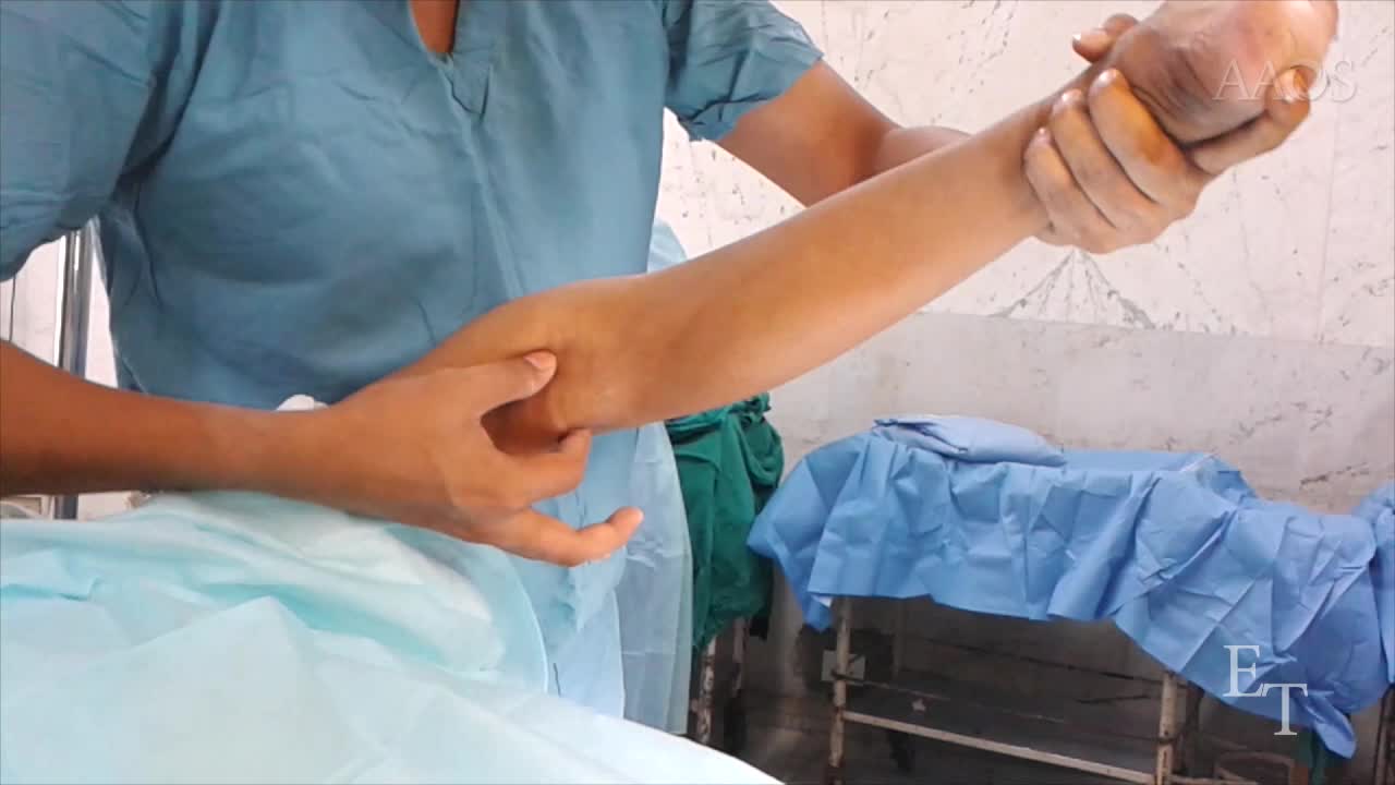 Arthroscopic Decompression of Popliteal Cyst