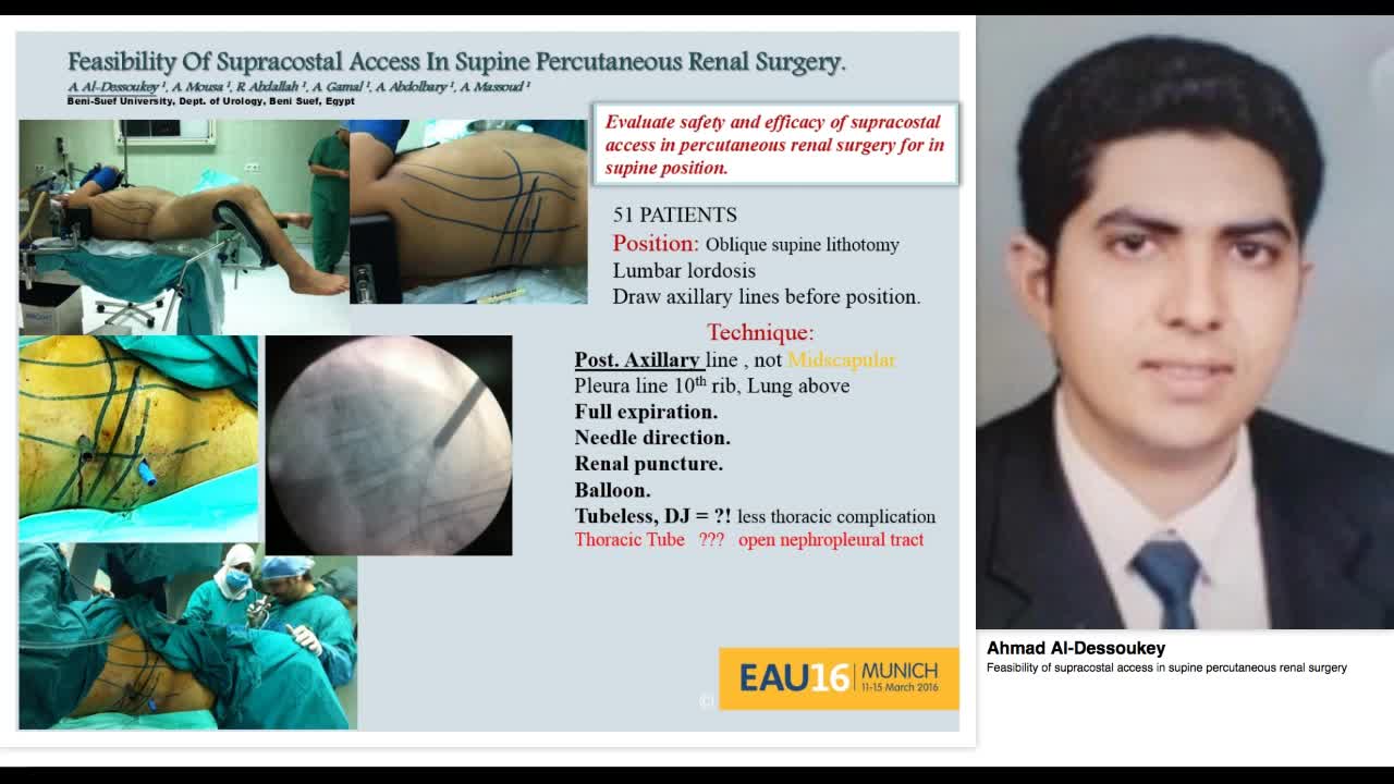 Feasibility of supracostal access in supine percutaneous -