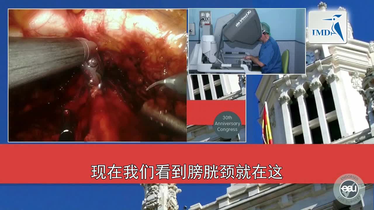 神经保留根治性前列腺切除术（3）