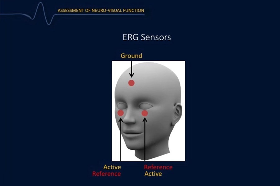 《眼科》2018年第1讲（总第26讲）视网膜电图在视网膜疾病诊断和管理中的作用（1）