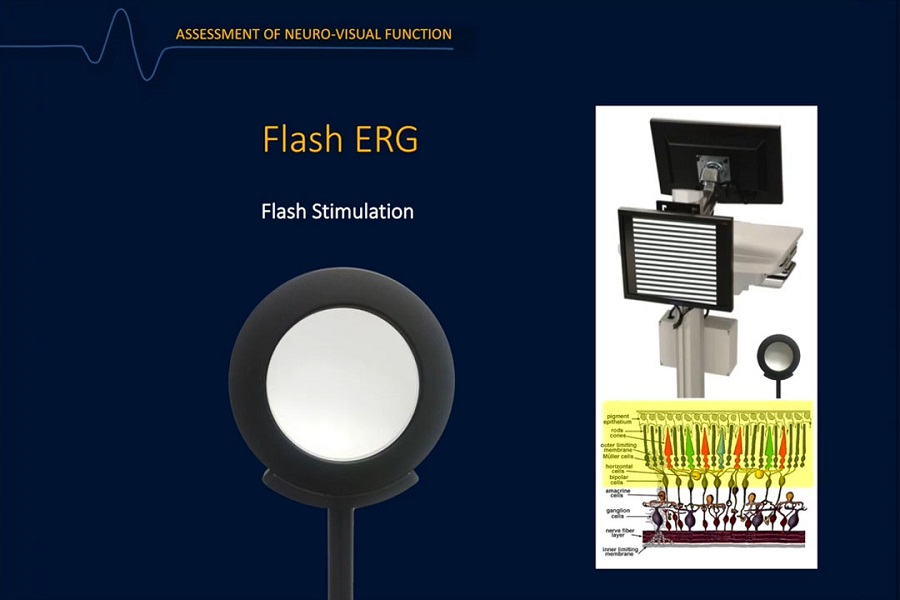 《眼科》2018年第2讲（总第27讲）视网膜电图在视网膜疾病诊断和管理中的作用（2）