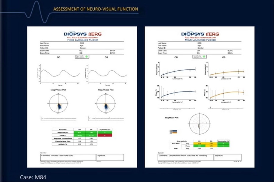 《眼科》2018年第3讲（总第28讲）视网膜电图在视网膜疾病诊断和管理中的作用（3）