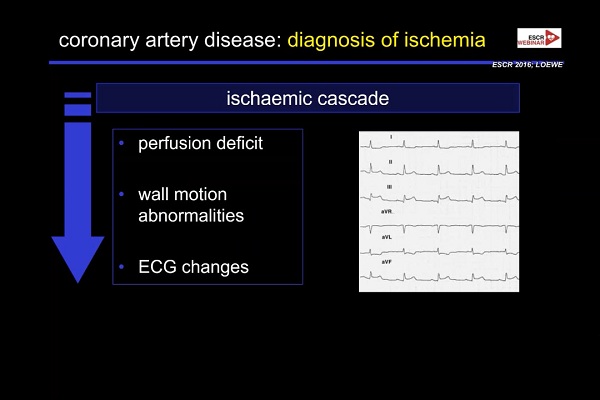 《心血管科》2018年第3讲（总第77讲）：急性冠状动脉综合征发作后的影像诊断（3）