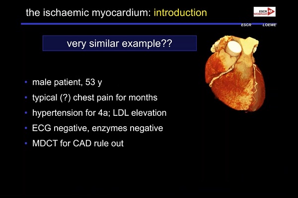 《心血管科》2018年第2讲（总第76讲）：急性冠状动脉综合征发作后的影像诊断（2）