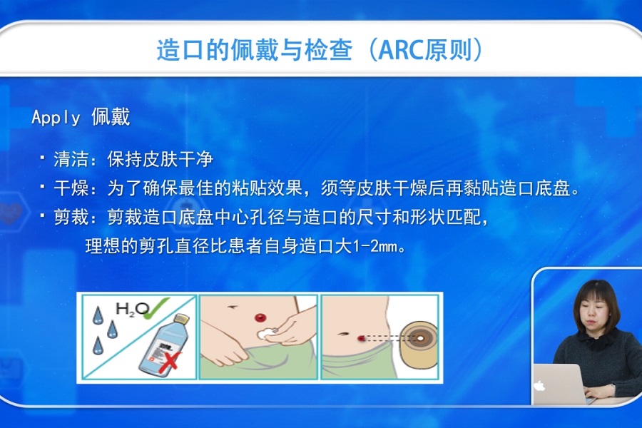 《护理大讲堂》2019年第2讲（总第2讲）造口护理