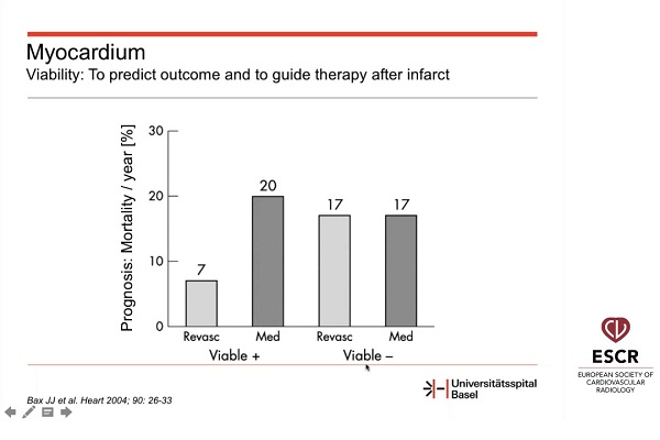 《心血管科》2018年第13讲（总第87讲）成像在器质性心脏病现代治疗中的作用（1）