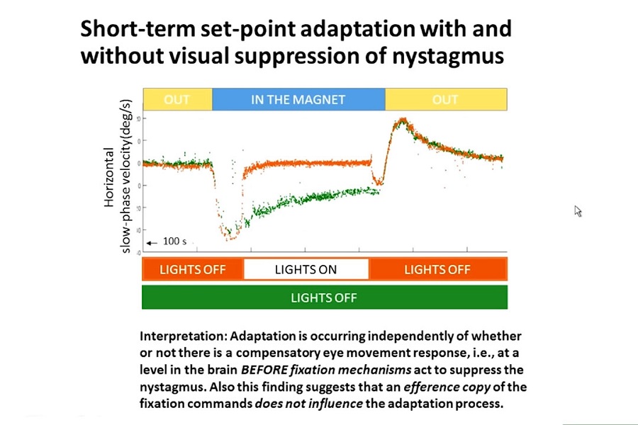 《眼科》2018年第8讲（总第33讲）磁前庭刺激：进展更新（4）