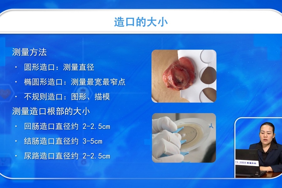 《护理大讲堂》2019年第8讲（总第8讲）造口术后护理
