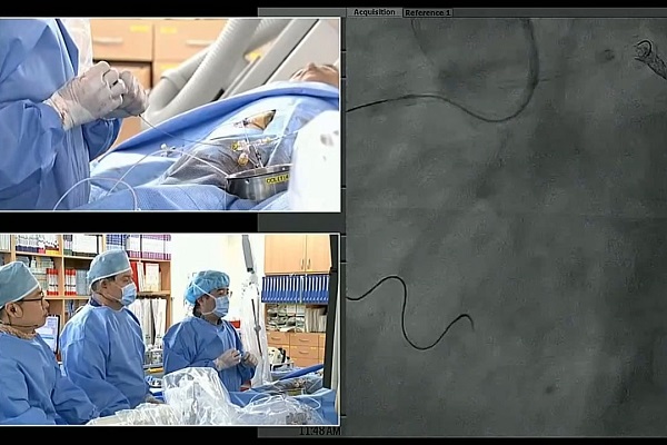 血管内手术现场案例（5）