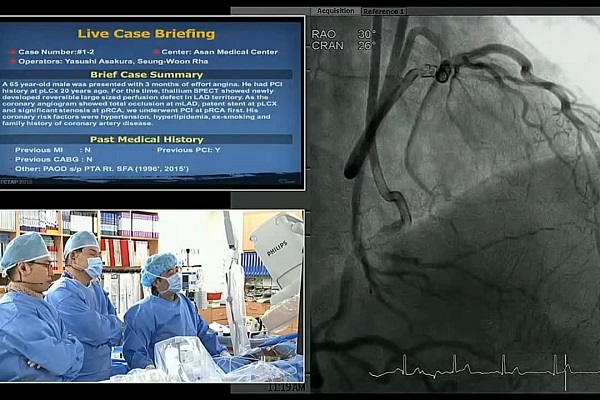 血管内手术现场案例（1）