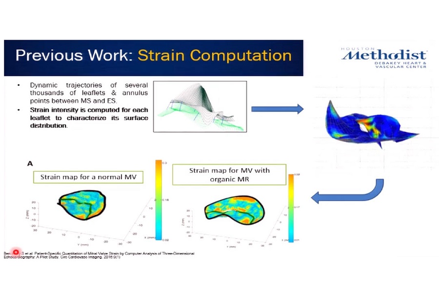 《胸外科》二尖瓣结构与功能（2）