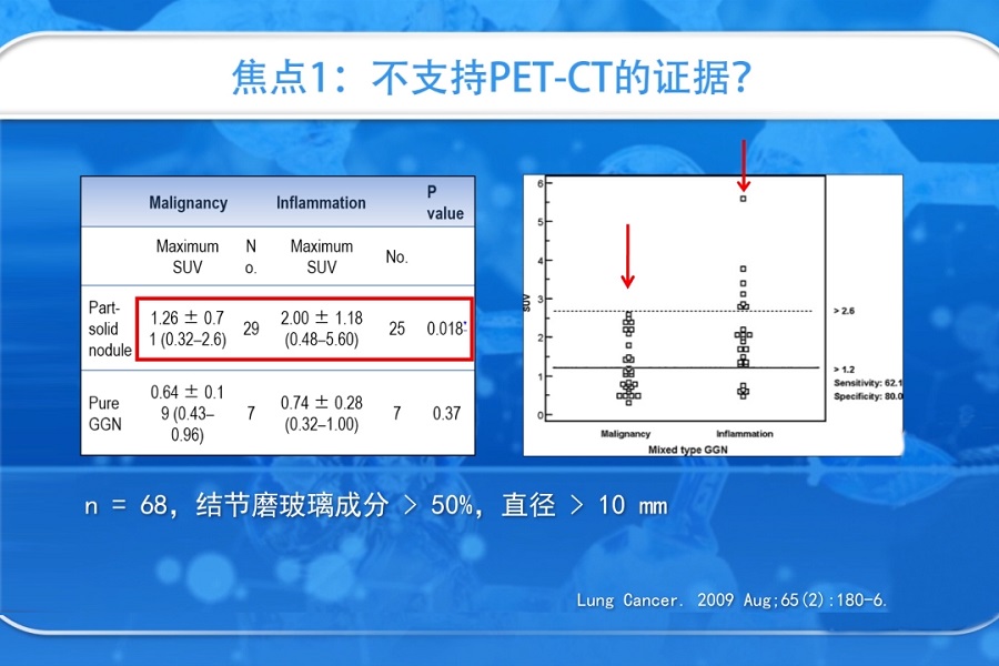 《结核和呼吸科频道》2019年第3讲（总第37讲）磨玻璃结节解读及指南进展（3）
