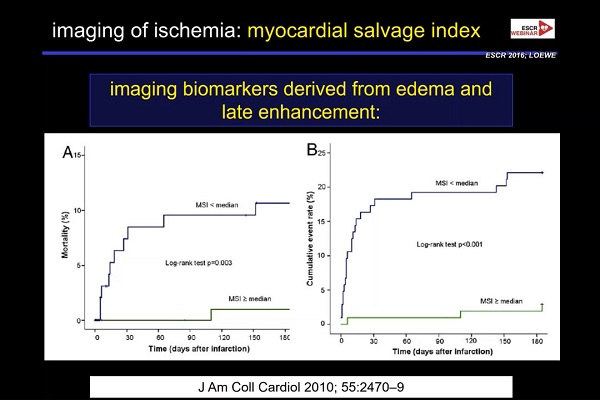 《心血管科》2018年第9讲（总第83讲）：急性冠状动脉综合征发作后的影像诊断（9）