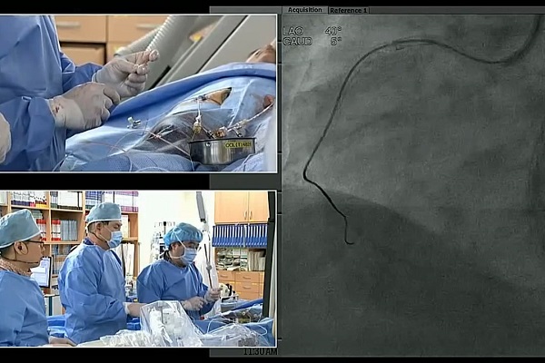 血管内手术现场案例（4）