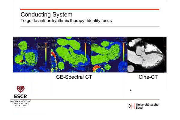 成像在器质性心脏病现代治疗中的作用（4）