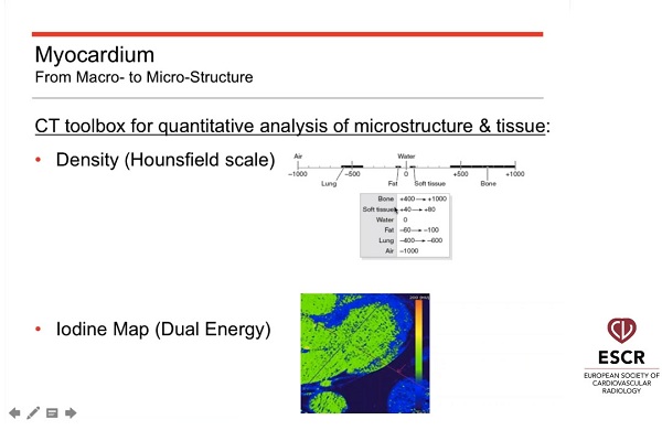 《心血管科》2018年第15讲（总第89讲）成像在器质性心脏病现代治疗中的作用（3）