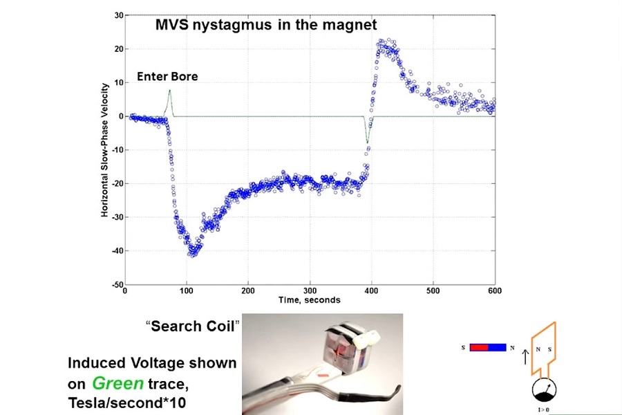 《眼科》2018年第5讲（总第30讲）磁前庭刺激：进展更新（1）