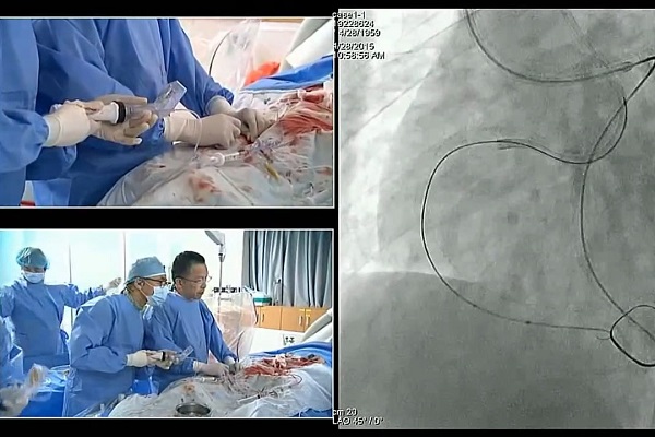 血管内手术现场案例（3）